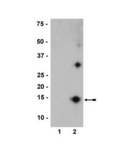 Millipore Anti-Nitro-Alpha/Beta-Synuclein Antibody, Clone Nsyn12
