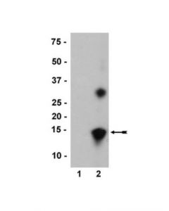 Millipore Anti-Nitro-Alpha/Beta-Synuclein (Tyr39) Antibody, Clone