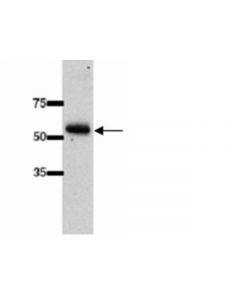 Millipore Anti-Ugt2b7 Antibody (Udp-Glycosyltransferase 2b Family,