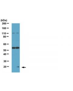 Millipore Anti-Phospho- Bad (Ser75) Antibody
