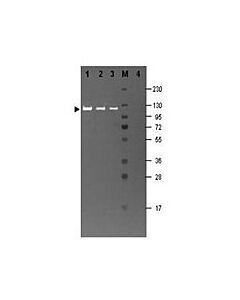 Millipore Anti-Beta Galactosidase Antibody