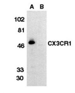 Millipore Anti-C-X-X-X-C Chemokine Receptor 1 Antibody, Extracellular