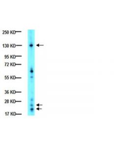Millipore Anti-Integrin Alphav Antibody, Ct, Intracellular