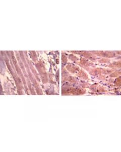 Millipore Anti-Atrial Natriuretic Polypetide Antibody, Alpha