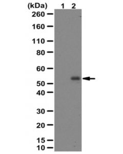 Millipore Anti-Phospho Smad2 Antibody (Ser465/467)