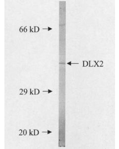Millipore Anti-Dlx2 Antibody