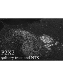 Millipore Anti-P2x2 Receptor Antibody