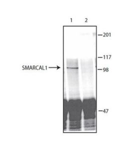 Millipore Anti-Smarcal1 Antibody