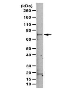 Millipore Anti-Rlim/Rnf12 Antibody