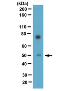 Millipore Anti-T-Box Transcription Factor Tbx5 Antibody