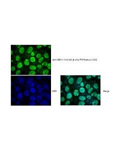 Millipore Anti-E3 Ubiquitin-Protein Ligase (Ubr5/Edd)