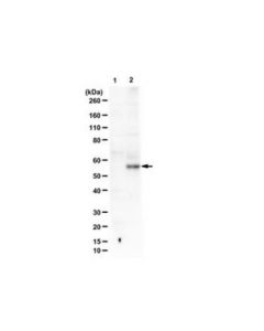 Millipore Anti-Phospho-Smad2 (Ser465 Antibody, Ser467)