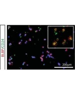 Millipore Anti-Brain Lipid Binding Protein Antibody
