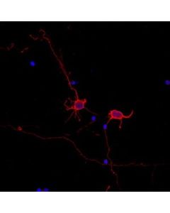 Millipore Neuro-Chrom Pan Neuronal Marker Antibody-Rabbit