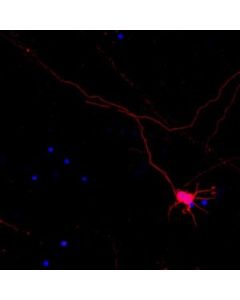 Millipore Neuro-Chrom Pan Neuronal Marker Antibody-Rabbit, Cy3 Conjugate