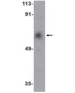 Millipore Anti-Acvr1c Antibody