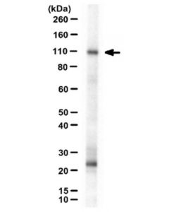Millipore Anti-Neph1 Antibody, Cytoplasmic Domain