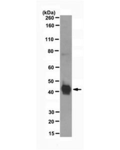 Millipore Anti-Phospho-Smad3 (Tyr179) Antibody