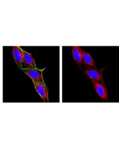 Millipore Anti-Macrophages/Granulocytes Antibody, Clone Ox-41