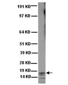 Millipore Anti-Frataxin Antibody, Exon 4, Clone 1g2