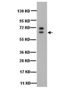 Millipore Anti-Cytokeratin 5 Antibody, 6, Clone D5/16b4