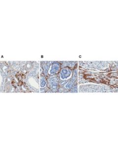 Millipore Anti-Laminin-5 Antibody, Clone P3e4