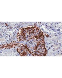 Millipore Anti-Wilms Tumor Antibody, Nt Clone 6f-H2, Ascites Free
