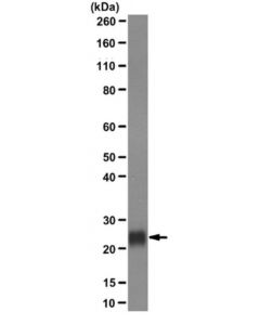 Millipore Anti-Plet-1 (Placenta-Expressed Transcript 1 Protein) Antibody,