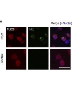 Millipore Anti-Huntingtin Protein Antibody, Clone Mem48