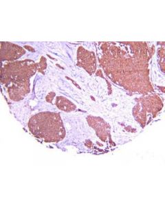Millipore Anti-Hypoxia Inducible Factor 1 Alpha Antibody, Clone H1alpha67
