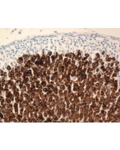 Millipore Anti-Cytochrome P450 11beta-Hydroxylase Antibody, Clone