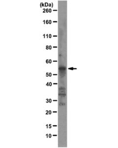 Millipore Anti-Fox1 Antibody, Clone D8f8