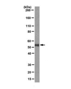 Millipore Anti-P53 Antibody, Clone Pab421