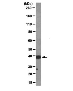 Millipore Anti-Macro-H2a1.2 Antibody, Clone 14g7