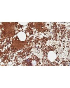 Millipore Anti-Fcgr2a/C Antibody, Clone 11b6