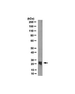 Millipore Anti-Retinoschisin Antibody, Clone 3r10