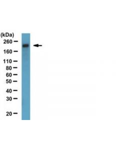 Millipore Anti-Zo-1 Antibody, Clone R40.76