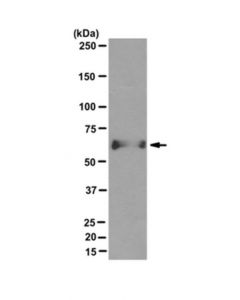 Millipore Anti-Aggrecan Antibody, Clone 6b4