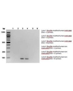 Millipore Cpgenome Human Methylated Dna Standard Set