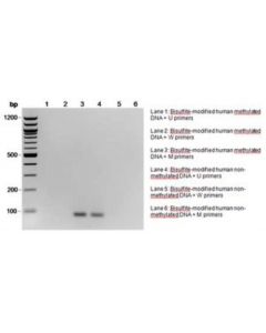 Millipore Cpgenome Human Non-Methylated Dna Standard Set
