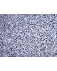 Millipore Tc28a2 Human Chondrocyte Cell Line