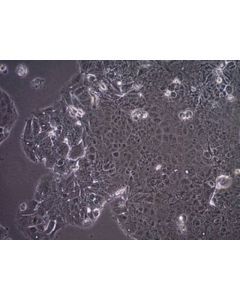 Millipore Mcf-7/S0.5 Human Breast Cancer Cell Line