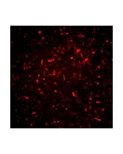Millipore Alzheimers In A Dish Psen1-Rfp Lentivirus