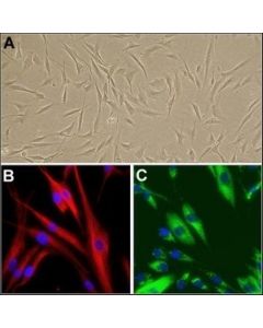Sigma-Aldrich Human Dermal Fibroblasts: Hdf, Adult; SIALMSD-106-05A