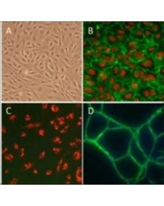 Sigma-Aldrich Human Umbilical Vein Endothelial Cells: Huvec, Neon; SIALMSD-200-05N